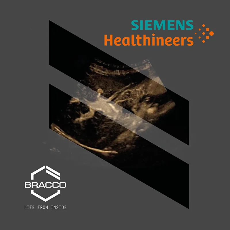 2024 CEUS Educational Event Bracco - Siemens