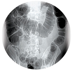Glowing x-ray image