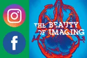 The Beauty of Imaging