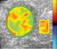 Vuebox Liver Tissue Analysis