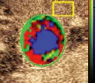 Vuebox Liver Tissue Analysis