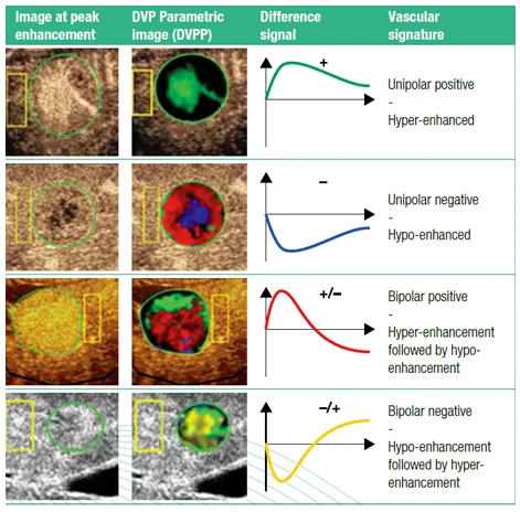 VueBox Dynamic Vascular Pattern Parametric