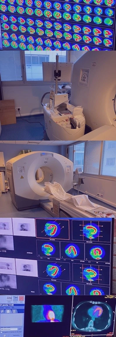 CARDIOGEN BRACCO