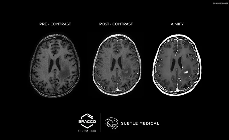 Bracco Imaging and Subtle Medical Announce CE Mark of AiMIFY™ Software for Enhanced MRI in Europe