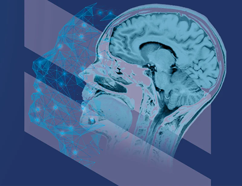 EUSOMII AI-powered Contrast Enhancement for Brain MRI