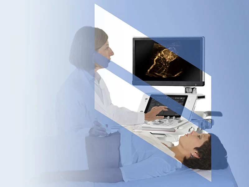 IBISCUS Webinar: CEUS and its benefits in Clinical Practice