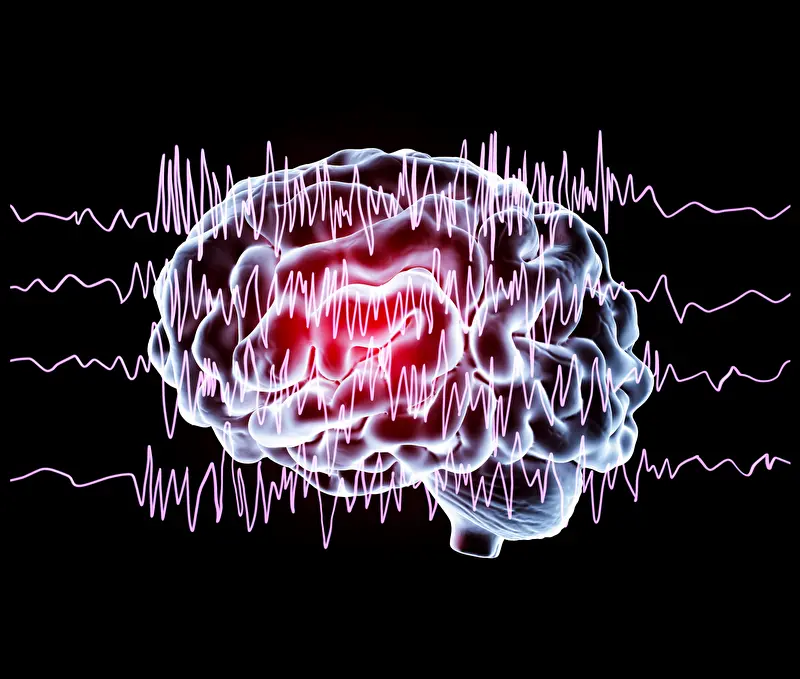 Acouphènes pulsatiles neuroradiologie webinaires Bracco 2026