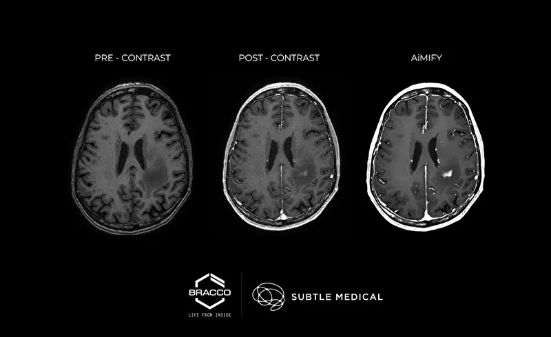 Novo marco global com a liberação da AIMIFY ANVISA Brasil 