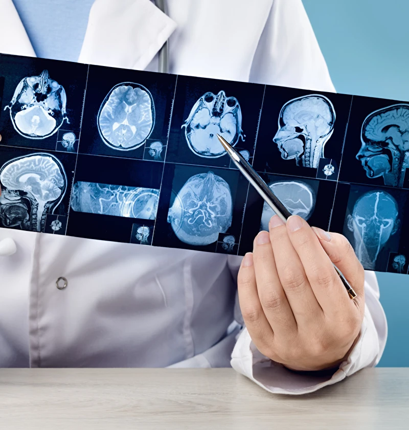 Images pièges en neuroradiologie webinaire Bracco 2026