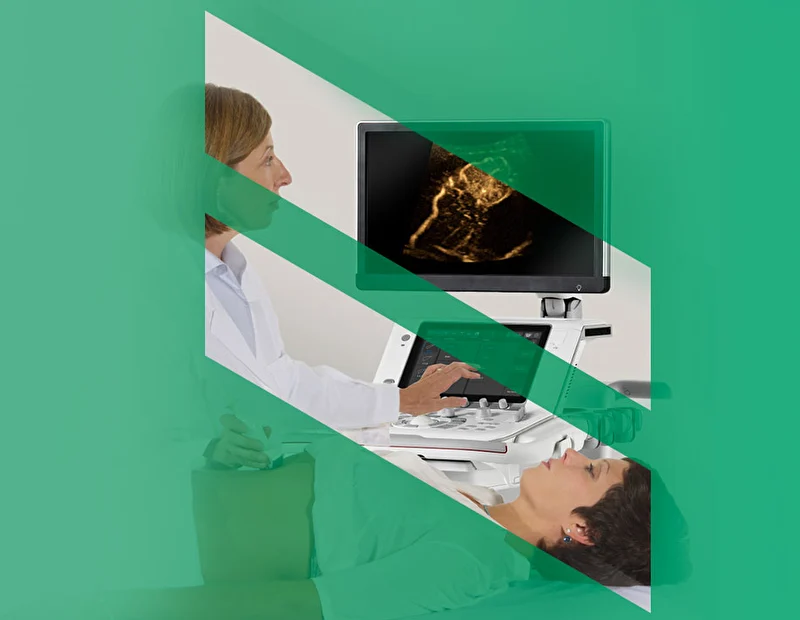 Bracco CEUS-Contrast Enhanced Ultrasound