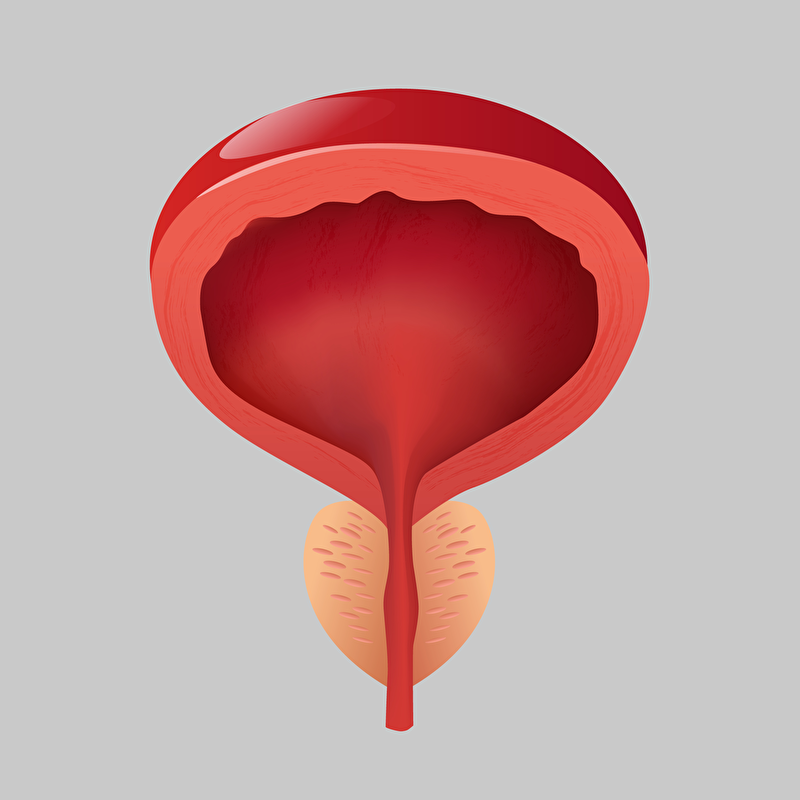 IRM PROSTATIQUE - WEBINAIRE 2026