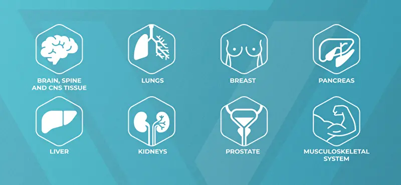 MRI VUEWAY Indications
