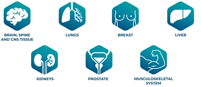 MRI VUEWAY Indications