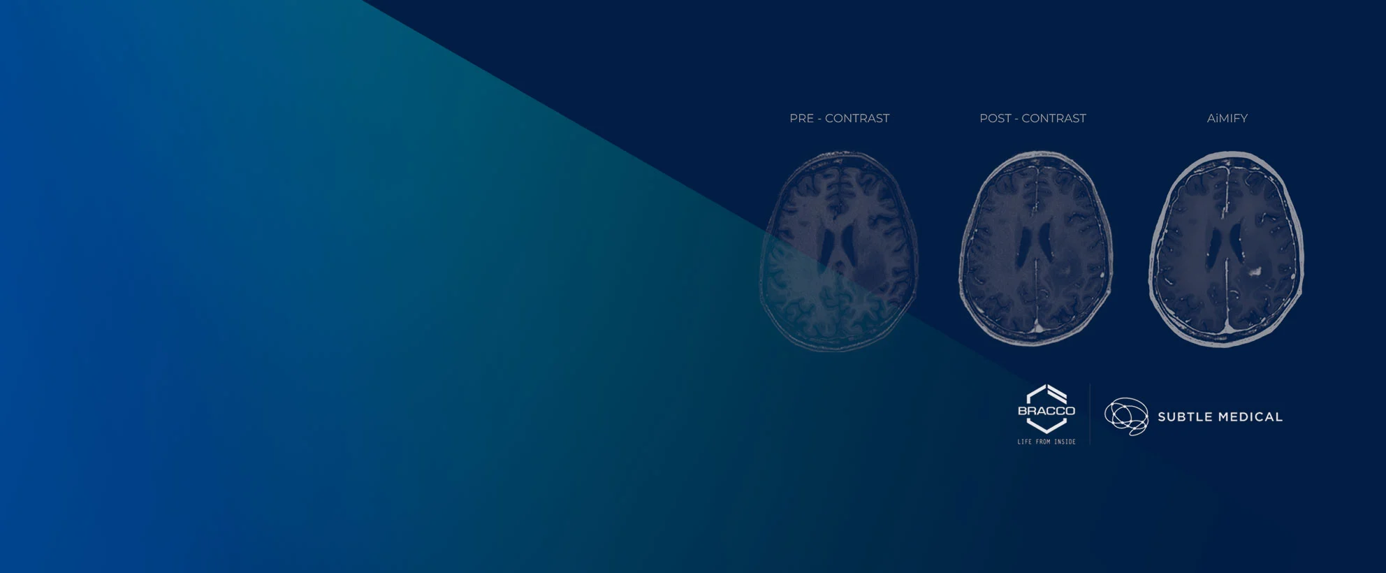 CE Mark of AiMIFY™ Software for Enhanced MRI in Europe