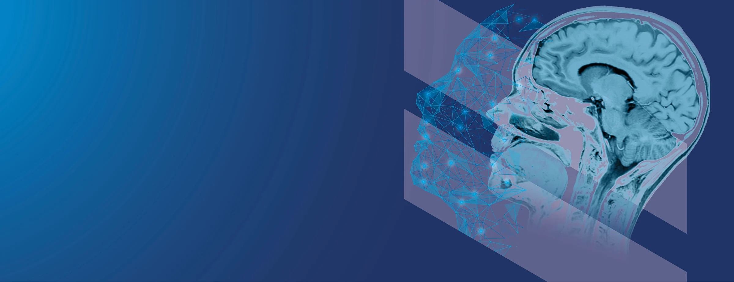 EUSOMII - AI-powered Contrast Enhancement for Brain MRI