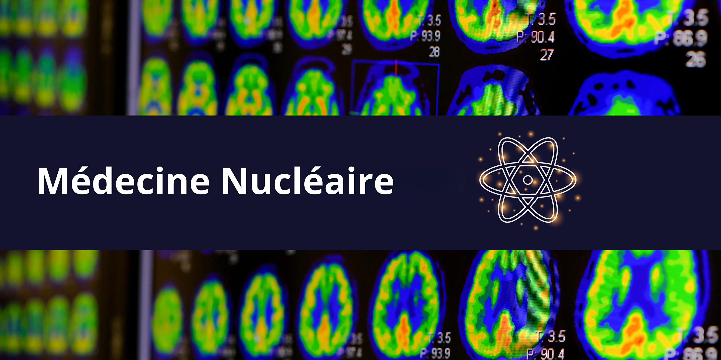 IMAGERIE MEDECINE NUCLEAIRE BRACCO