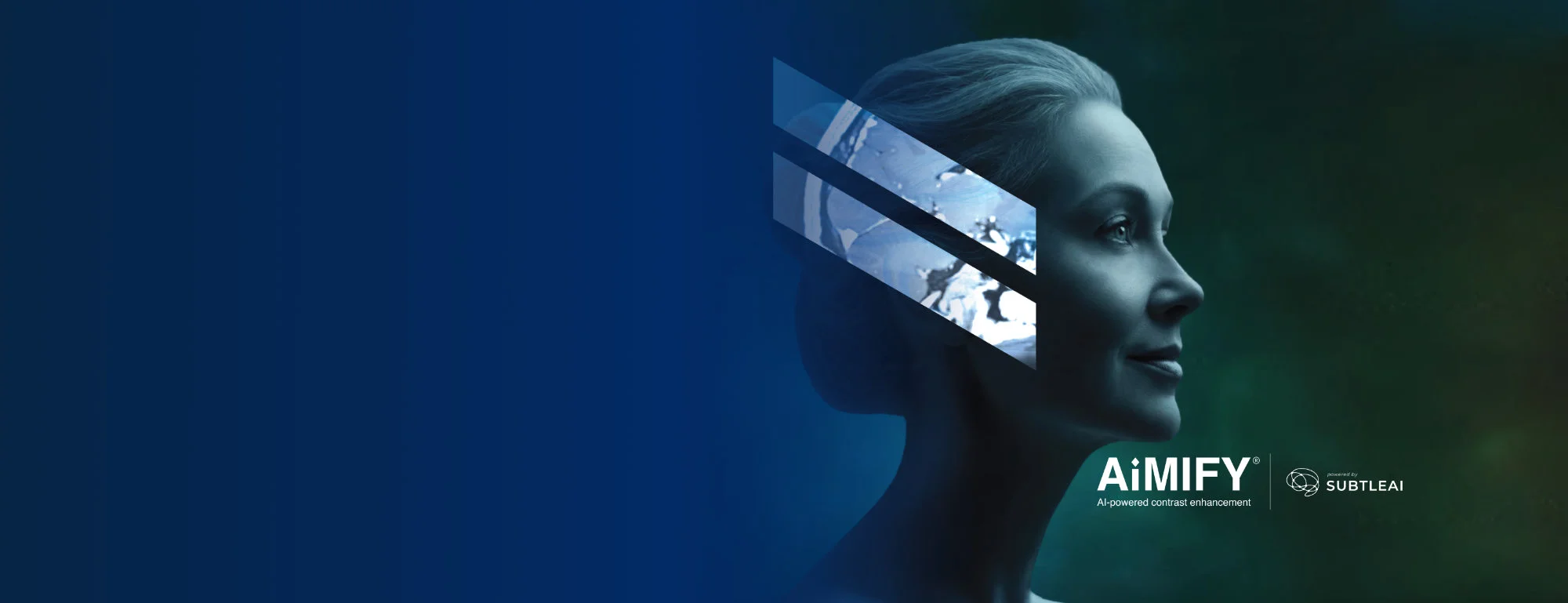 Bracco Announces EU Launch of AiMIFY and Expands AI Portfolio