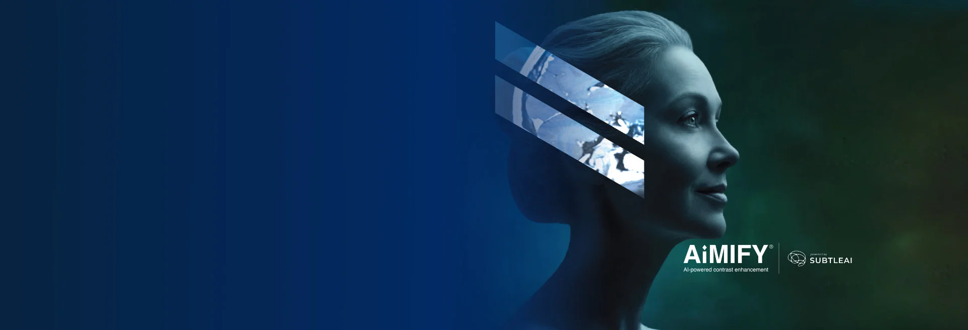 Bracco Announces EU Launch of AiMIFY and Expands AI Portfolio